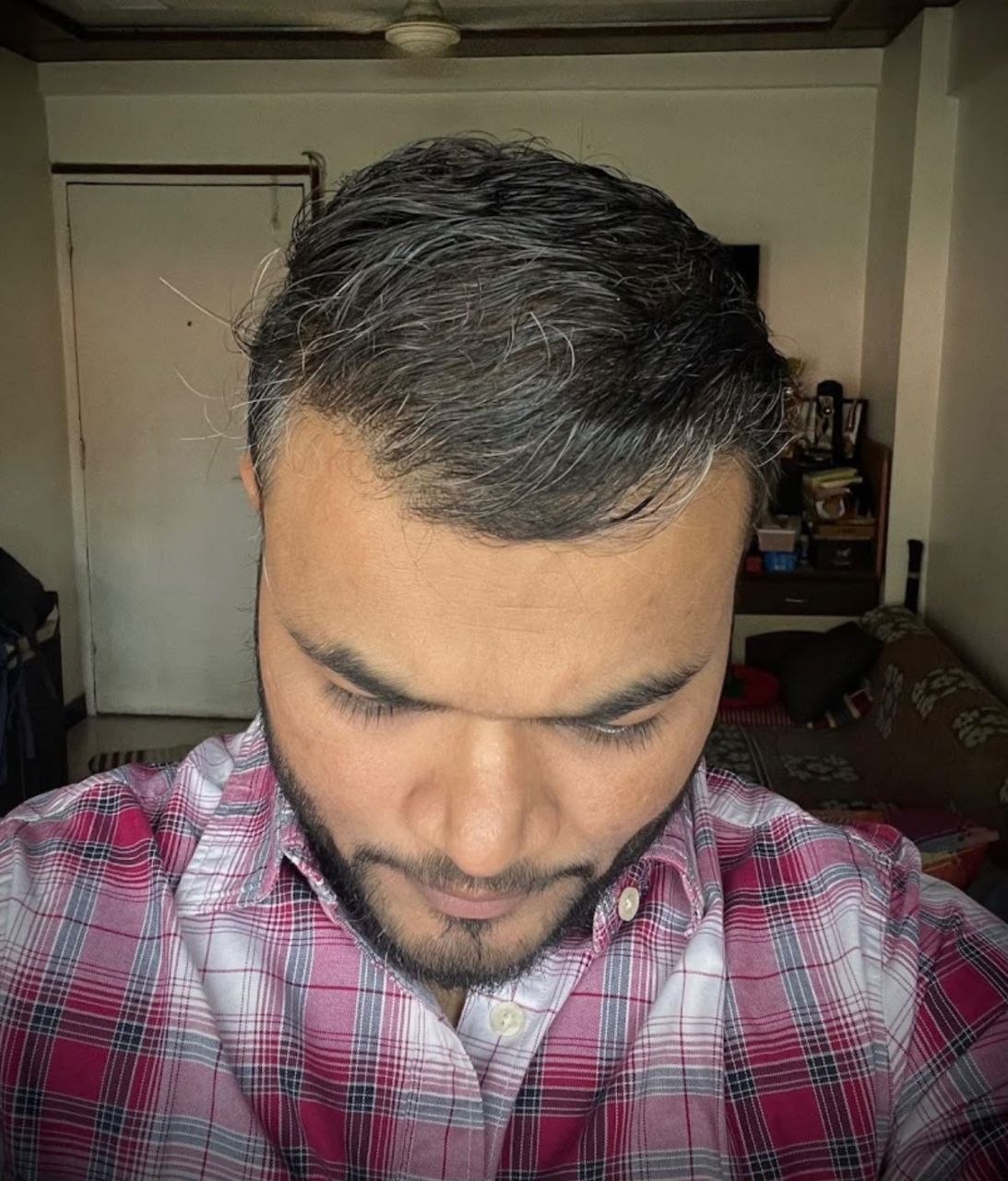 Hair restoration after treatment