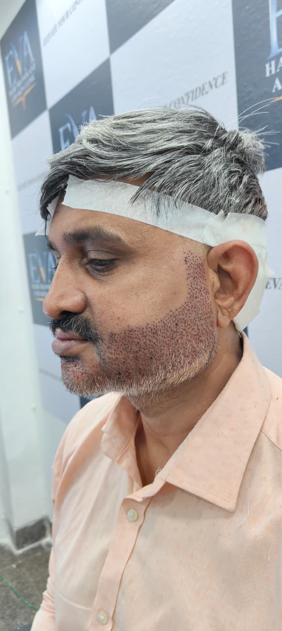 EVA Clinic patient gallery image 6